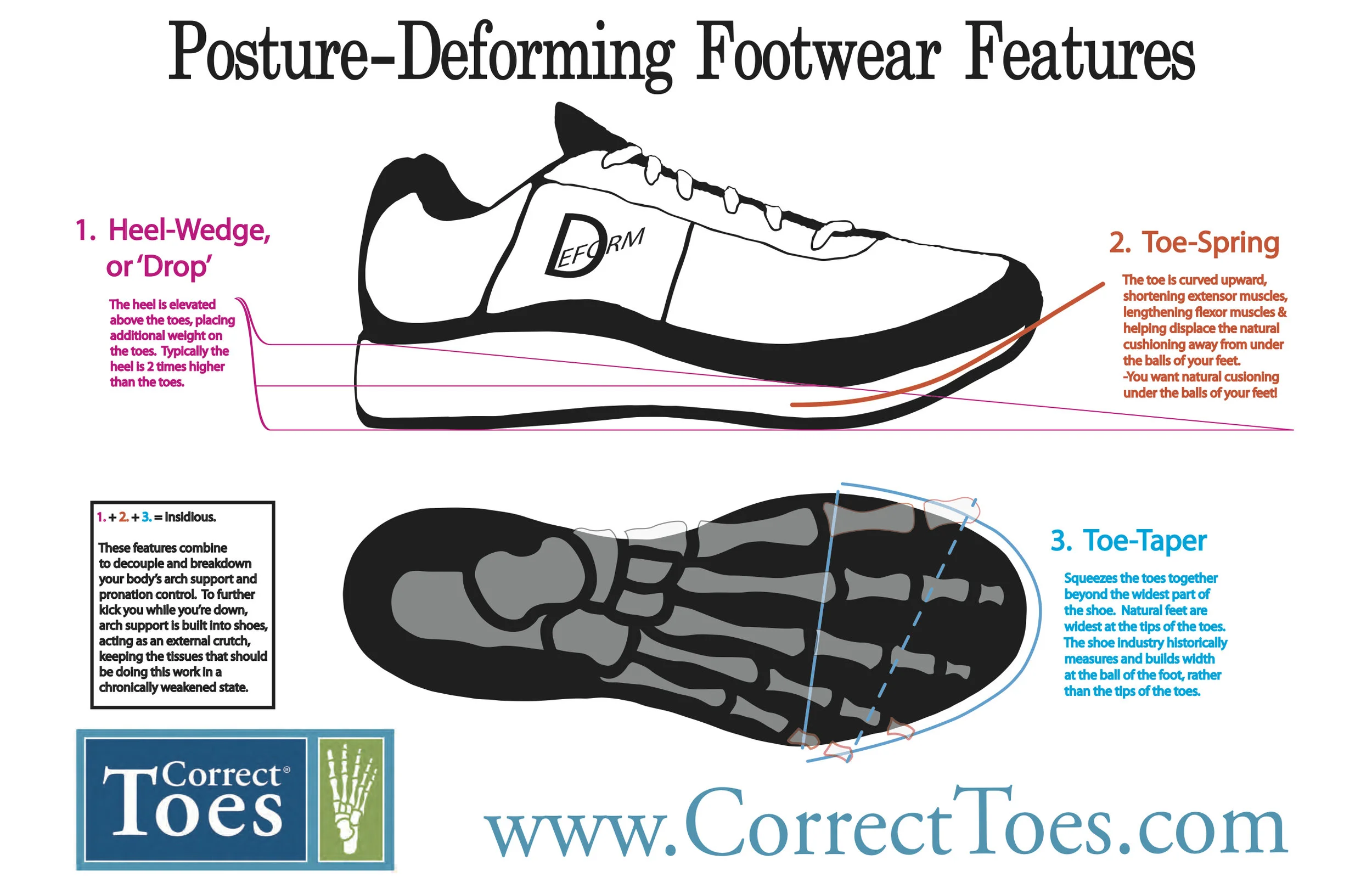 Posture-Deforming Footwear Features